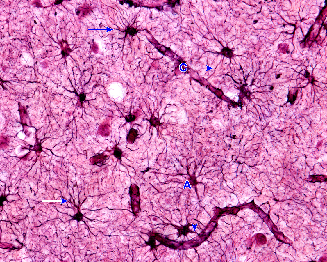 histología de oligodendrocitos